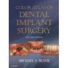 Color Atlas of Dental Implant Surgery by Block DMD, Michael S ...